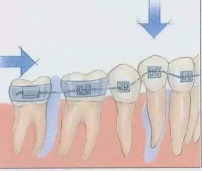 做梦老是梦到牙齿松动或掉落代表哪？解析梦境中的牙齿象征与心理暗示