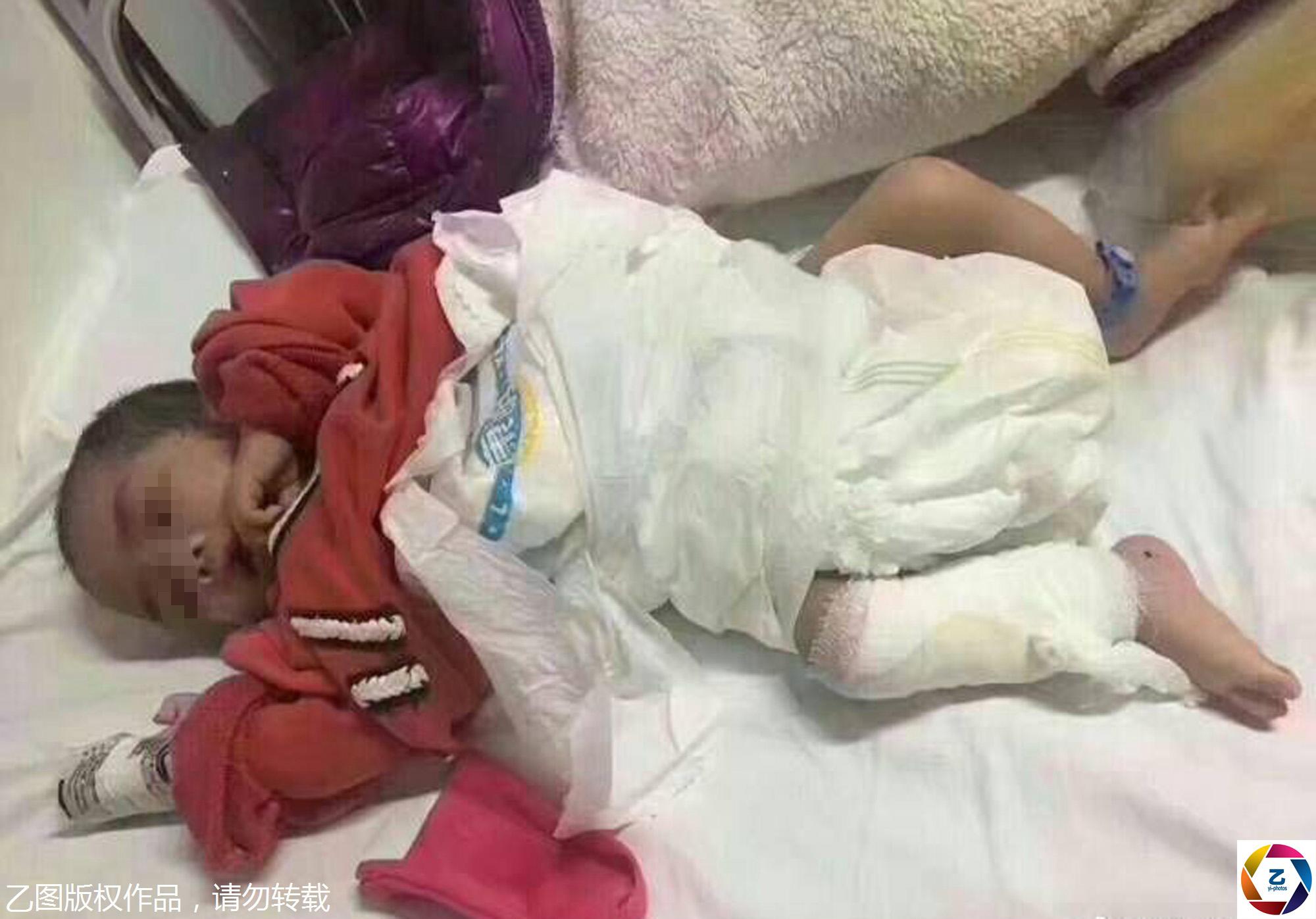 梦境的深意,解读梦见被死去的奶奶咬到手的预兆 梦境的深意,解读梦见被死去的奶奶咬到手的预兆