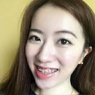 武汉市戴牙套哪个医院好