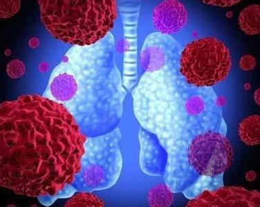 【人类偏肺病毒正在美国肆虐
 ,人类偏肺病毒症状体征】