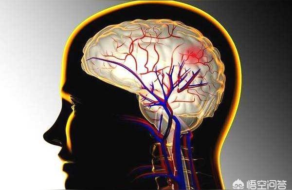 脑与神经疾病杂志免费论文网站计算神经科学的目的是