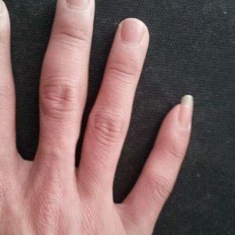 男人为什么会肾虚