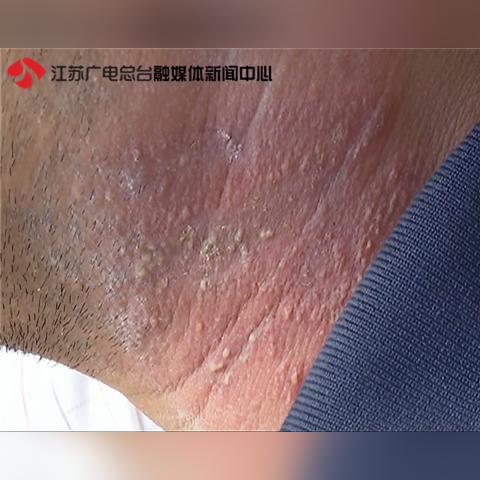 南通市皮肤研究所在哪里