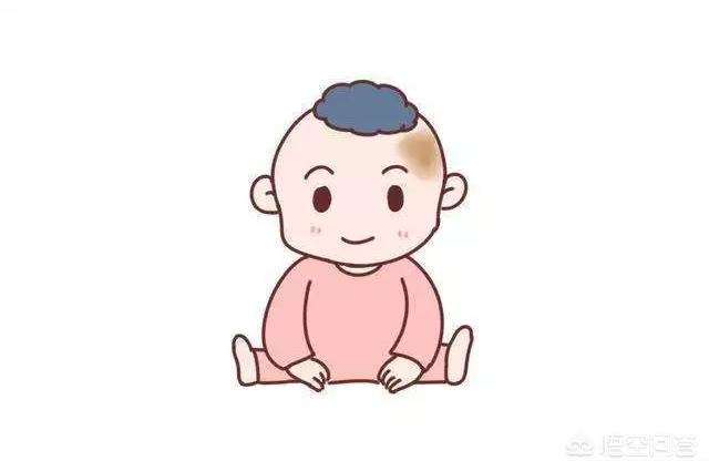 后背胎记算命胎记的寓意和象征