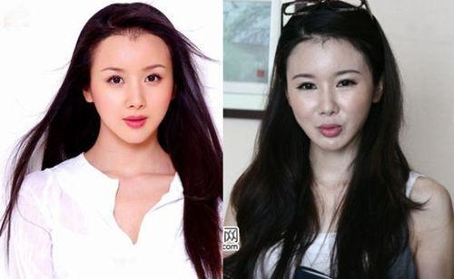 孙菲菲整容后遗症而哪些网红却越来越像明星