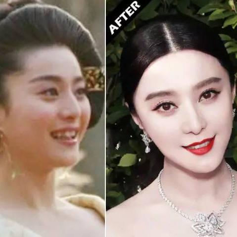 广州牙美容价格相关长尾关键词有哪些