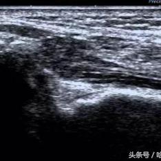 哈尔滨治疗宫颈囊肿相关长尾关键词有哪些