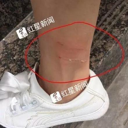 西安市预防接种证怎么办