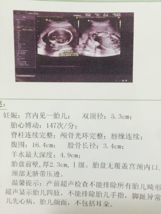 胎梦解析,梦到这些,预示着可能迎来小王子——生男孩的胎梦指南 胎梦解析,梦到这些,预示着可能迎来小王子——生男孩的胎梦指南