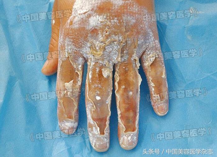 建筑机械化论文库如何做好施工现场的消防安全管理论文