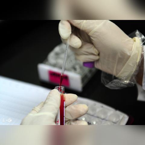 怎样在网上查询个人体检报告？