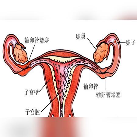 合肥做输卵管造影相关长尾关键词有哪些