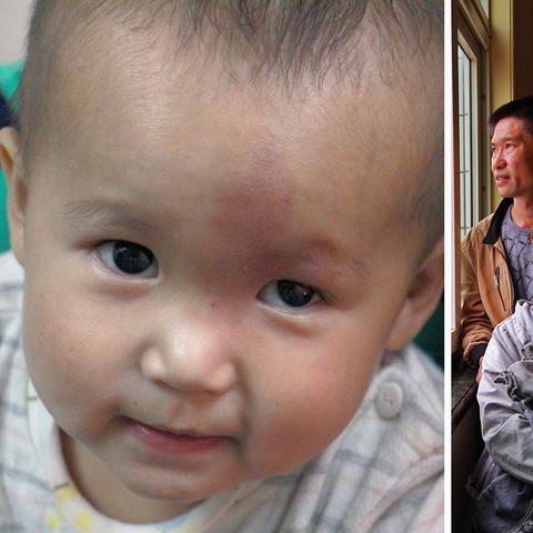 合肥肿瘤医院待遇相关长尾关键词有哪些