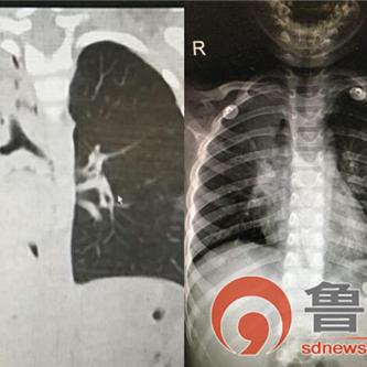 济南齐鲁医院手术室相关长尾关键词有哪些