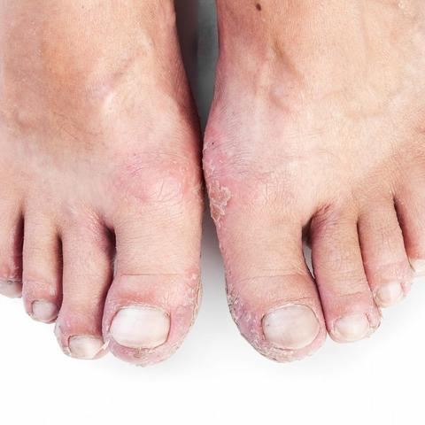 沈阳皮炎L酊相关长尾关键词有哪些