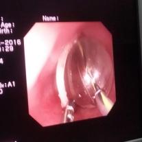 大连无痛人流大概要多少钱的长尾关键词有什么