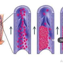 如何固定水泵？