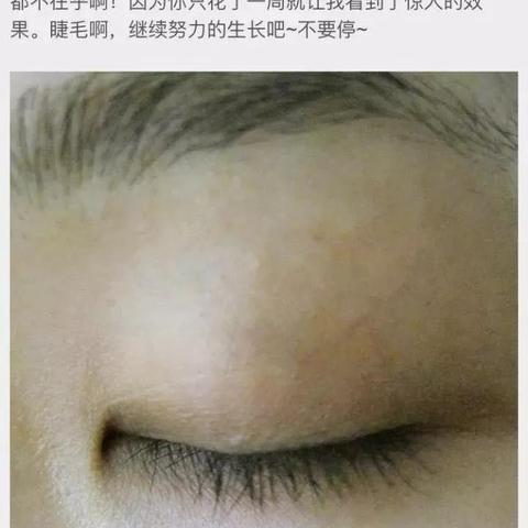 祛黑眼圈微商文案的长尾关键词有哪些