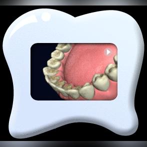 武汉市医院洗牙挂什么科