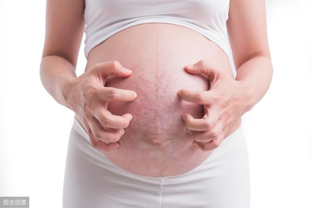 这4种孕妈可能不会长妊娠纹