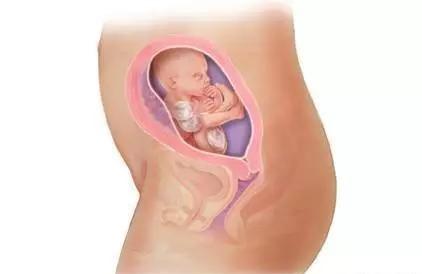 静脉曲张对胎儿有影响吗