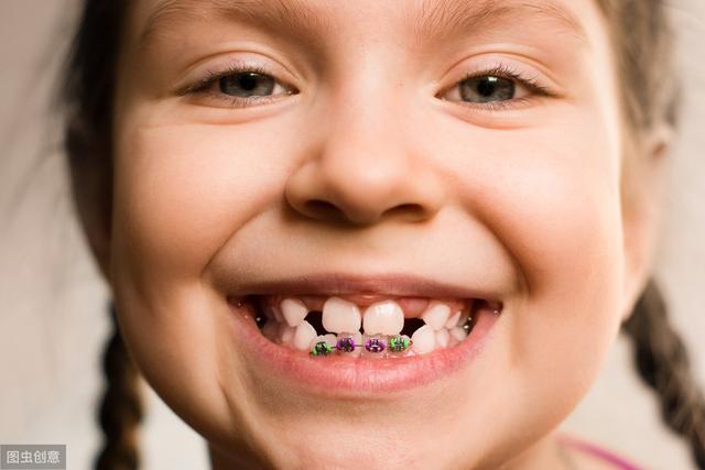 儿童牙齿预防的措施有哪些