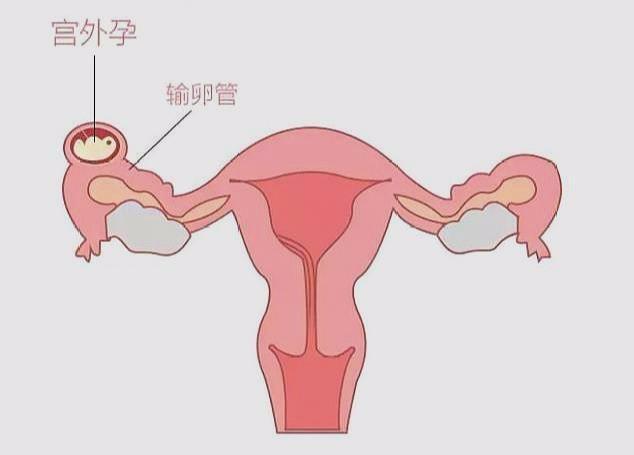 孕期什么时候是胎儿畸形高发期