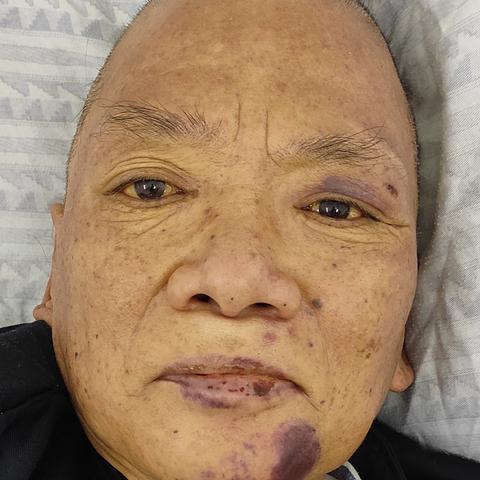 广州65岁以上人员补助最新标准？