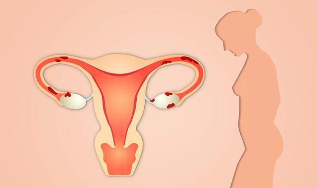 一个月来两次月经正常吗是什么原因