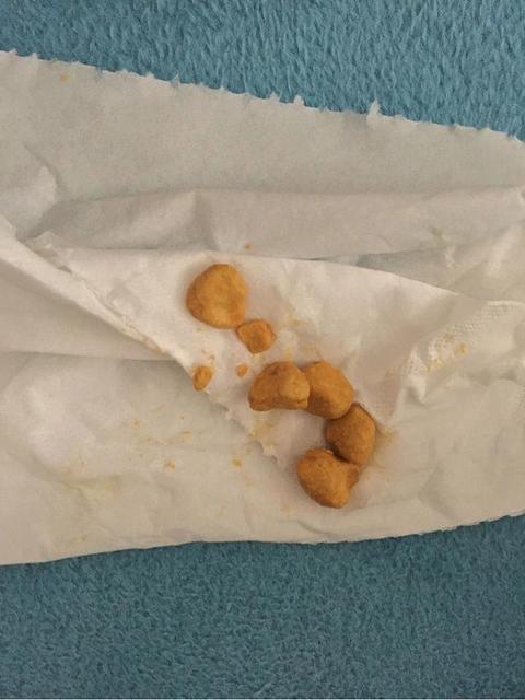 孩子总是拉颗粒状的便便是怎么回事