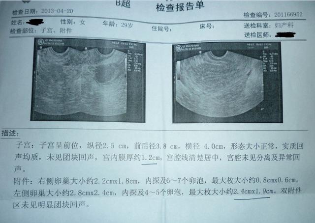 卵泡期吃什么好
