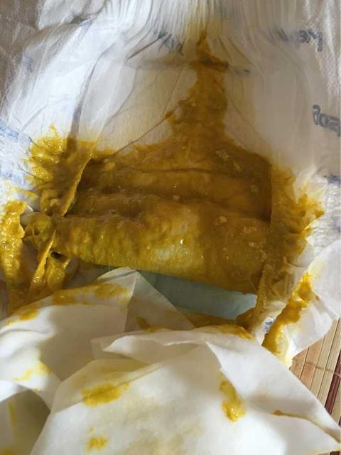 4个月的宝宝拉肚子怎么办拉水