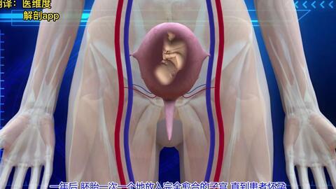 女性子宫小会影响生育吗