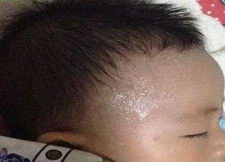 小孩子爱睡觉还出虚汗是什么原因