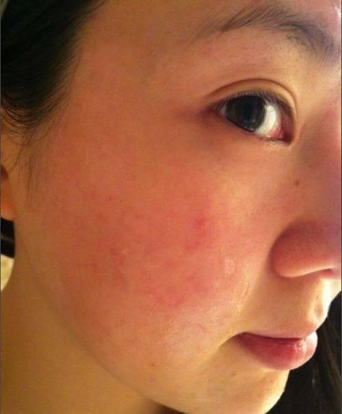 宝宝的皮肤干燥该如何解决