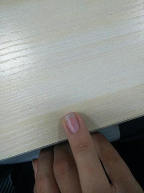 小孩子的指甲凹凸不平是什么原因