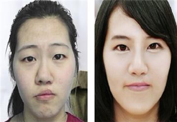 首页项目中心整形美容中心口唇整形>>唇腭裂修复华美优势