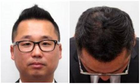 人一年要掉多少根头发