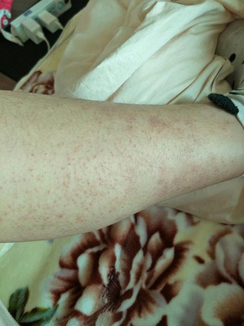 怀孕晚期下体痒怎么回事