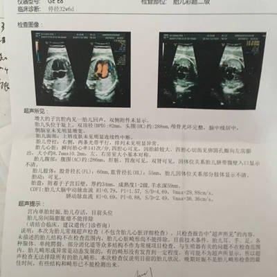 卵圆孔未闭合是先天性心脏病吗