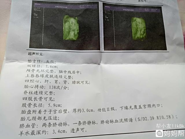 孕32周羊水指数多少正常?