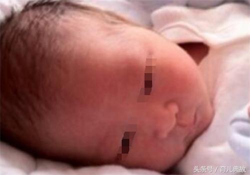 八个月宝宝拉肚子吃什么好