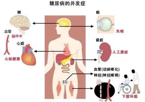 糖耐量试验是什么意思