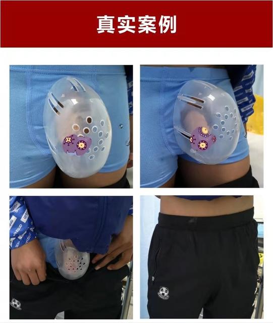 男生为什么要做包茎手术