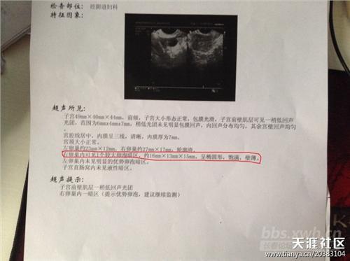 卵泡发育不好吃什么药