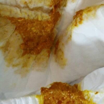 宝宝拉肚子有血丝怎么回事