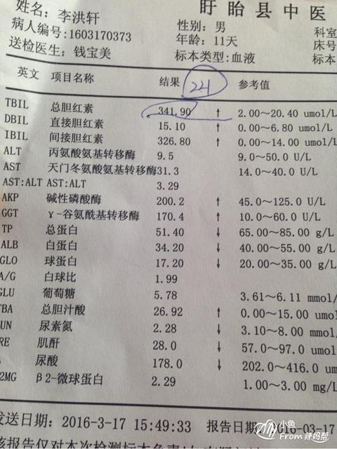 新生儿出现黄疸的原因