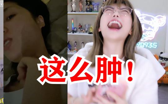 内卷之王周淑怡，拔牙还不忘赚钱!被柴西拔牙吓到了