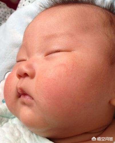 10种易引起婴儿湿疹的食品