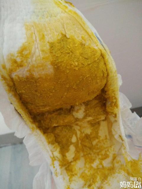 宝宝拉肚子可以给他吃益生菌吗